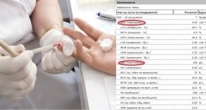 как да разчетем правилно кръвната картина