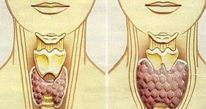 Десетки жени регулираха щитовидната си жлеза за 2 месеца