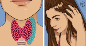 Всяка втора жена има проблем с щитовидната жлеза – 8 важни симптома които не трябва да подценяваме