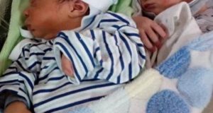 Жена роди близнаци а лекарите и мъжът й онемяха щом видяха бебетата СНИМКИ