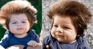 Помните ли 2-месечното бебе с най-гъстата коса? Вижте как изглежда днес (Снимки)
