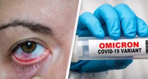 "Розово око" - новият симптом на Омикрон + още 8 нетипични знака че сте го пипнали: